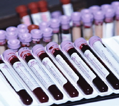 StemCell_Therapy_KosmMed